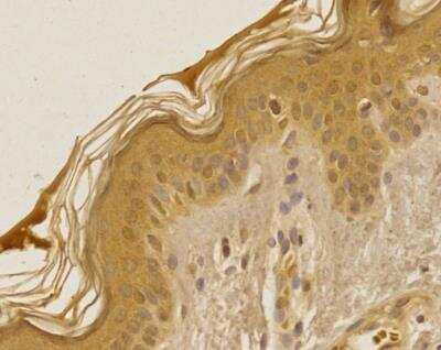 Immunohistochemistry-Paraffin: TREX1 Antibody - BSA Free [NBP2-29617]