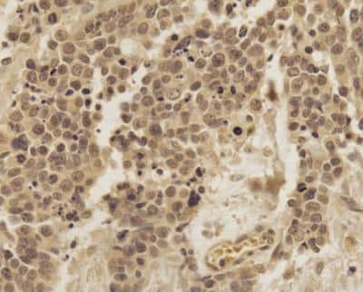 Immunohistochemistry-Paraffin: TREX1 Antibody - BSA Free [NBP2-29617]