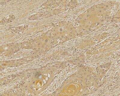 Immunohistochemistry-Paraffin: TREX1 Antibody - BSA Free [NBP2-29617]