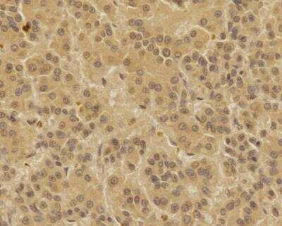 Immunohistochemistry-Paraffin: TREX1 Antibody - BSA Free [NBP2-29617]
