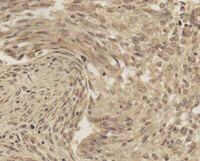 Immunohistochemistry-Paraffin: TREX1 Antibody - BSA Free [NBP2-29617]