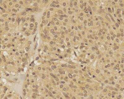 Immunohistochemistry-Paraffin: TREX1 Antibody - BSA Free [NBP2-29617]