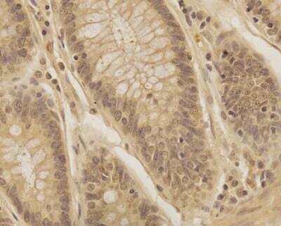 Immunohistochemistry-Paraffin: TREX1 Antibody - BSA Free [NBP2-29617]