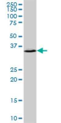 Western Blot: TREX1 Antibody [H00011277-D01P]