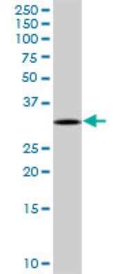Western Blot: TREX1 Antibody [H00011277-D01P]