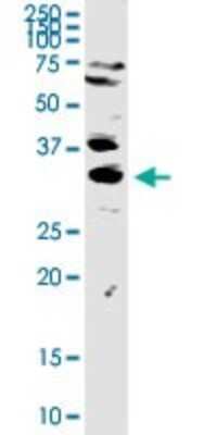 Western Blot: TREX1 Antibody [H00011277-D01P]