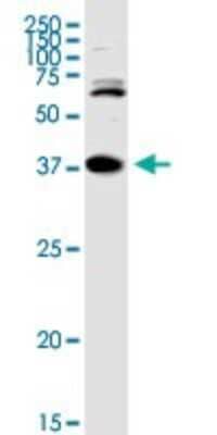 Western Blot: TREX1 Antibody [H00011277-D01P]