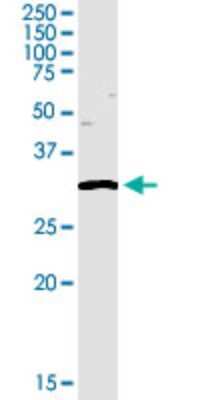 Western Blot: TREX1 Antibody [H00011277-D01P]