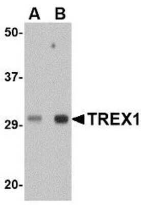 Western Blot: TREX1 AntibodyBSA Free [NBP1-76977]