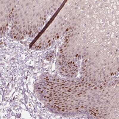 Immunohistochemistry: TREX2 Antibody [NBP2-30552]