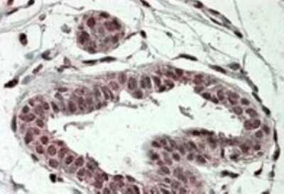 Immunohistochemistry-Paraffin: TREX2 Antibody [NBP1-36998]