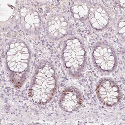 Immunohistochemistry-Paraffin: TREX2 Antibody [NBP2-30552]