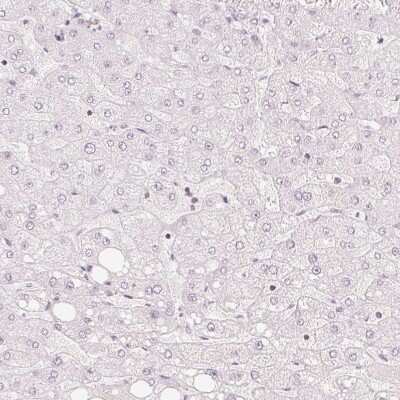 Immunohistochemistry-Paraffin: TREX2 Antibody [NBP2-30552]