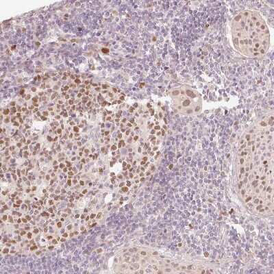 Immunohistochemistry-Paraffin: TREX2 Antibody [NBP2-30552]