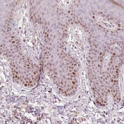 Immunohistochemistry-Paraffin: TREX2 Antibody [NBP2-30552]