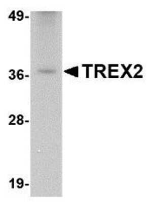 Western Blot: TREX2 AntibodyBSA Free [NBP1-76978]