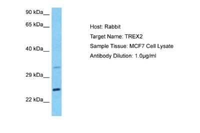 Western Blot: TREX2 Antibody [NBP2-88464]