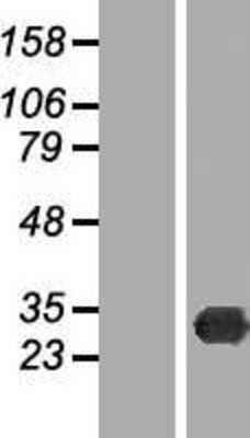 Western Blot: TREX2 Overexpression Lysate [NBP2-05769]