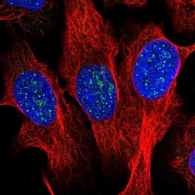 Immunocytochemistry/ Immunofluorescence: TRF-1 Antibody [NBP2-57285]