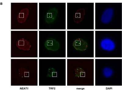 Immunocytochemistry/ Immunofluorescence: TRF-2 Antibody (4A794.15) - Azide Free [NBP2-33212]