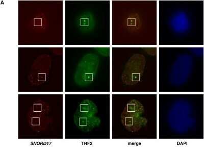Immunocytochemistry/ Immunofluorescence: TRF-2 Antibody (4A794.15) - Azide Free [NBP2-33212]