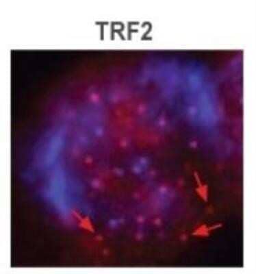 Immunocytochemistry/ Immunofluorescence: TRF-2 Antibody (4A794.15) - Azide Free [NBP2-33212]