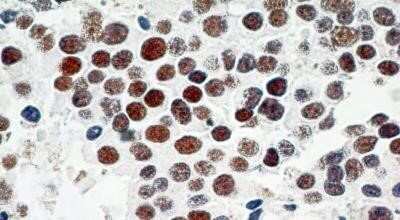 Immunohistochemistry: TRF-2 Antibody (4A794.15) - Azide Free [NBP2-33212]