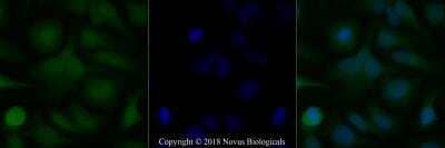 Immunocytochemistry/ Immunofluorescence: TRF-2 Antibody (4A794.15) - BSA Free [NB100-56506]