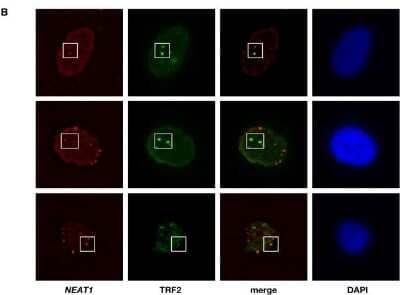 Immunocytochemistry/ Immunofluorescence: TRF-2 Antibody (4A794.15) - BSA Free [NB100-56506]