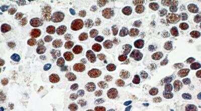 Immunohistochemistry-Paraffin: TRF-2 Antibody (4A794.15) - BSA Free [NB100-56506]