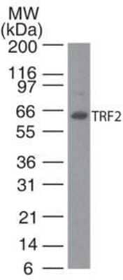 Western Blot: TRF-2 Antibody (4A794.15)BSA Free [NB100-56506]
