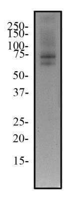 Western Blot: TRF-2 Antibody (4A794.15)BSA Free [NB100-56506]