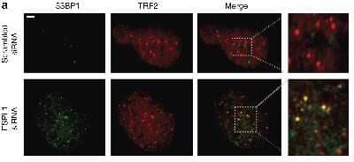 Immunocytochemistry/ Immunofluorescence: TRF-2 Antibody - BSA Free [NB110-57130]