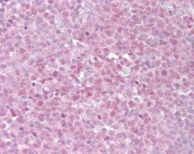 Immunohistochemistry-Paraffin: TRF-2 Antibody [NB100-56694]