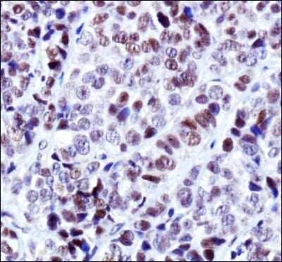 Immunohistochemistry-Paraffin: TRF-2 Antibody - BSA Free [NB110-57130]