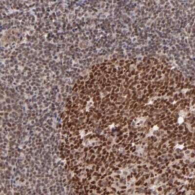 Immunohistochemistry-Paraffin: TRF-2 Antibody [NBP1-86910]