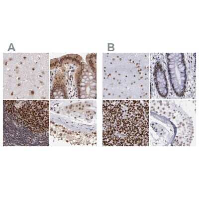 Immunohistochemistry-Paraffin: TRF-2 Antibody [NBP1-86910]