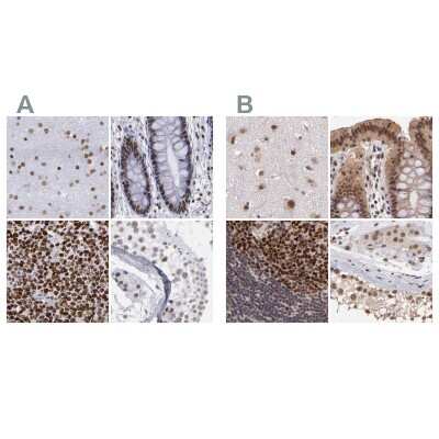 Immunohistochemistry-Paraffin: TRF-2 Antibody [NBP1-86911]