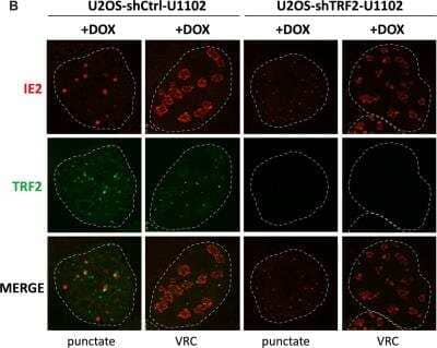 Knockdown Validated: TRF-2 Antibody [NB100-56694]