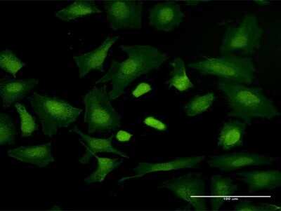 Immunocytochemistry/ Immunofluorescence: TRGV3 Antibody [H00006976-B01P]