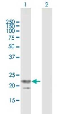 Western Blot: TRGV3 Antibody [H00006976-B01P]