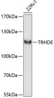 Western Blot: TRH-degrading Ectoenzyme/TRHDE AntibodyBSA Free [NBP2-93415]