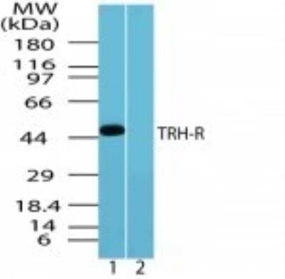 Western Blot: TRHR Antibody [NBP2-24726]