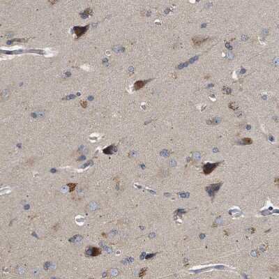 Immunohistochemistry-Paraffin: TRIAD3 Antibody [NBP1-86907]