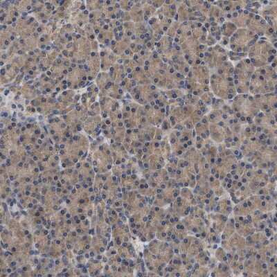 Immunohistochemistry-Paraffin: TRIAD3 Antibody [NBP1-86907]