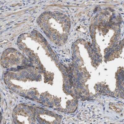 Immunohistochemistry-Paraffin: TRIAD3 Antibody [NBP1-86907]