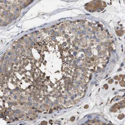 Immunohistochemistry-Paraffin: TRIAD3 Antibody [NBP1-86907]