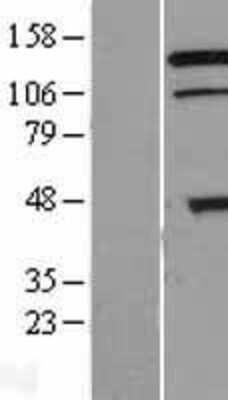 Western Blot: TRIAD3 Overexpression Lysate [NBL1-15444]