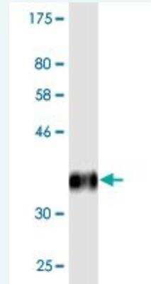 Western Blot: TRIB1 Antibody (6E5) [H00010221-M02]