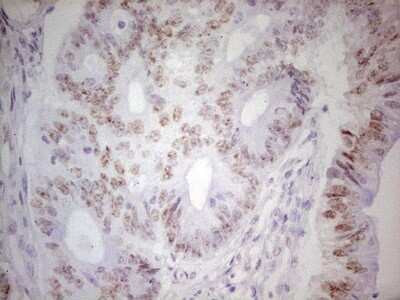 Immunohistochemistry: TRIB1 Antibody (OTI8C8) [NBP2-46205]